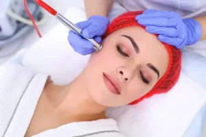 Acne Treatment in Clapham